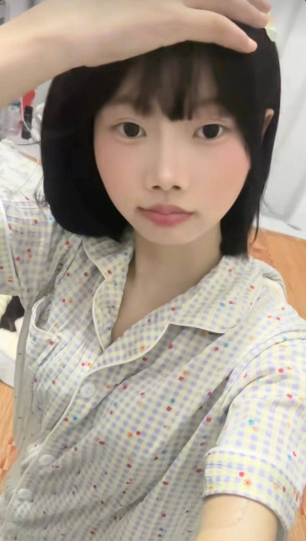 国元配资 江西21岁女生因白血病不幸去世，从确诊到去世仅4个多月，生前曾发帖称身上出现莫名瘀青